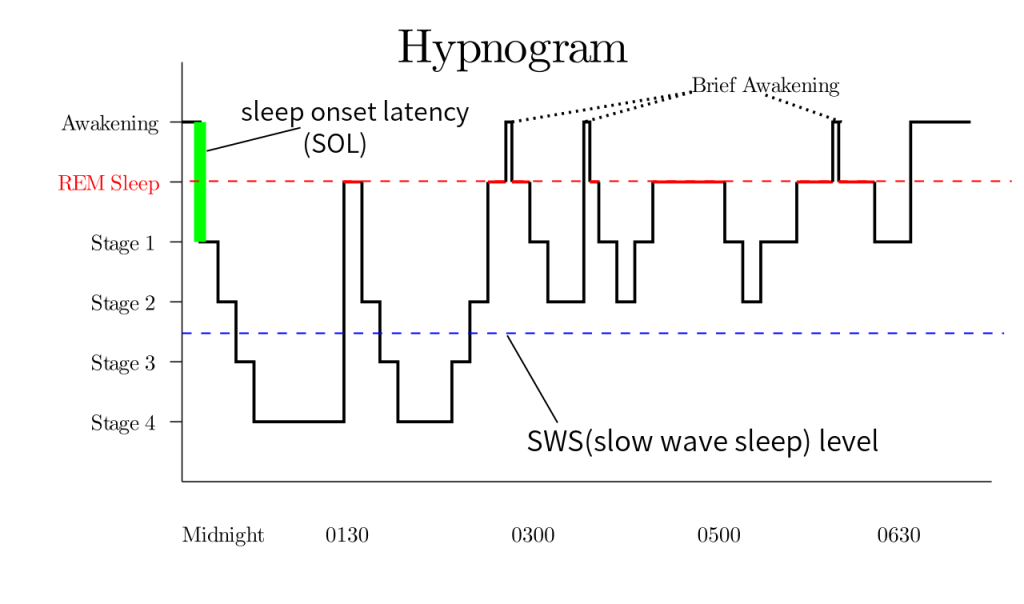 “The_master_circadian_clock_in_the_human_brain.jpg” by Ian B. Hickie, Sharon L. Naismith, Rébecca Robillard, Elizabeth M. Scott, and Daniel F. Hermens is licensed under CC BY 3.0 Image of a hypnogram showing stages of sleep