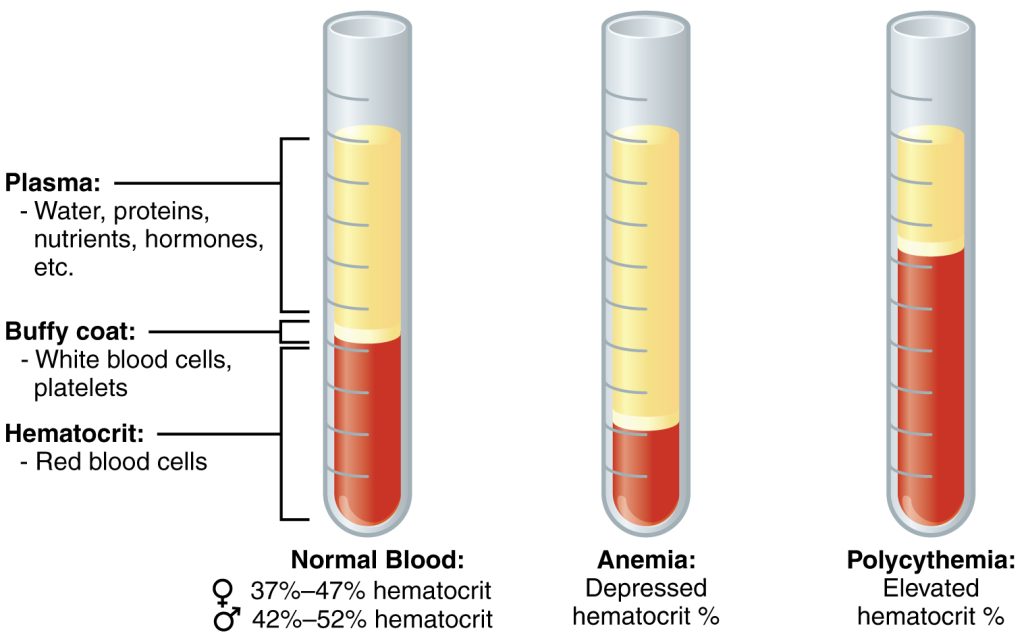 “1901_Composition_of_Blood.jpg” by Arabic is licensed under CC BY 3.0 Illustration showing Effects of Fluid Imbalance on Hematocrit