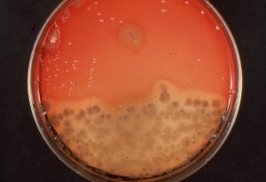 “m241-8 Blood agar culture of sputum from patient with pneumonia. Comprimised host. Colonies of Candida albicans and pseudomonas aeruginosa (LeBeau)” by Microbe World is licensed under CC BY-NC-SA 2.0 Image showing Sputum Culture