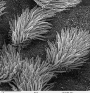“Bronchiolar_epithelium_3_-_SEM.jpg” by Charles Daghlian CC0 Image showing the mucociliary escalator
