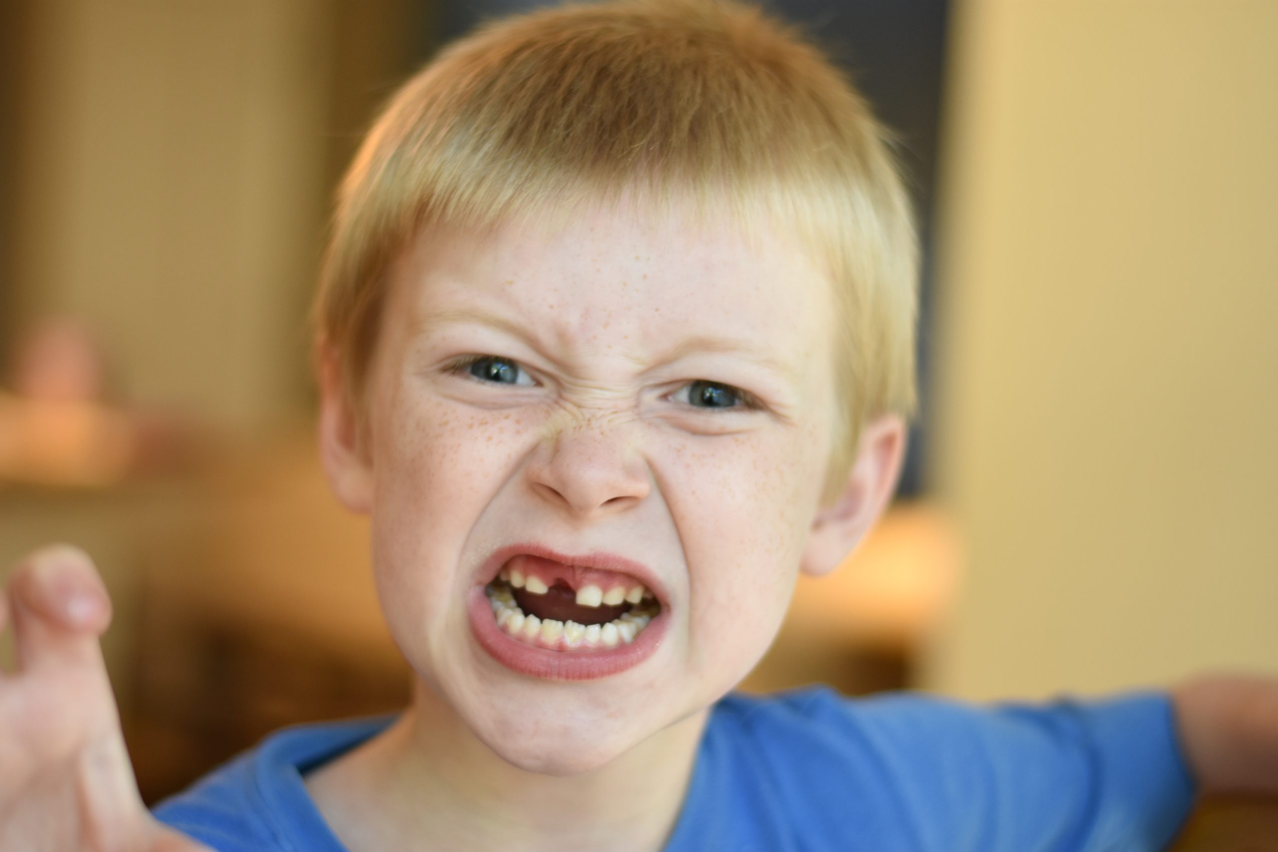 “Child%27s_Angry_Face.jpg” by Babyaimeesmom is licensed under CC BY-SA 4.0 Image showing a child with an angry scowl