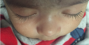 “Eyelashes_of_a_2-month-old_baby_boy.png” by Karthik.yerramilly is licensed under CC BY-SA 4.0 Image showing closeup of young child's eyelashes.