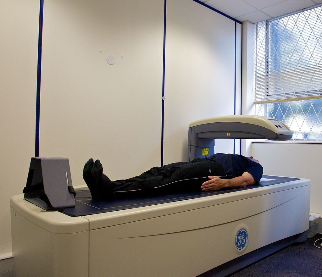 A Dual-energy X-ray absorptiometry (DEXA) scan being administered at the Avon Longitudinal Study of Parents and Children (ALSPAC) clinic in Bristol, UK. A man lies on the scanner while the arm of the scanner moves over him, taking a full scan of his body tissue density.