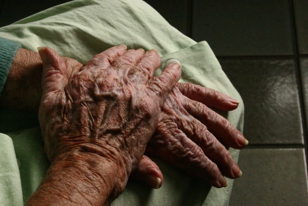 Hands folded showing wrinkles and veins due to age.