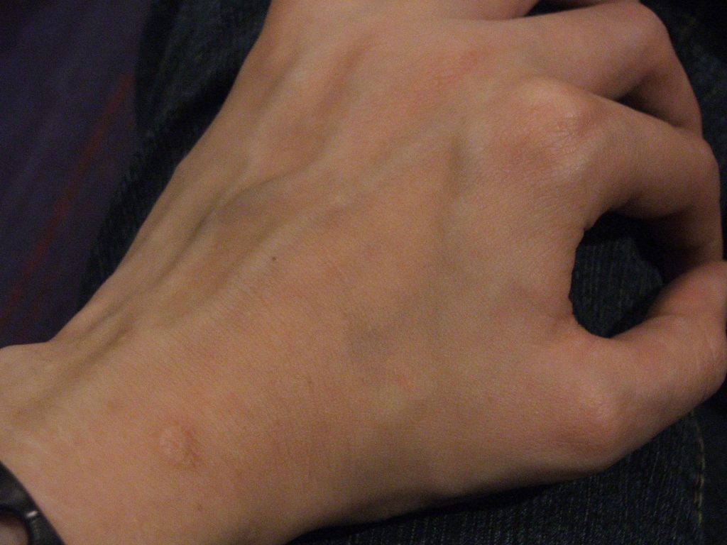 Hand with visible veins