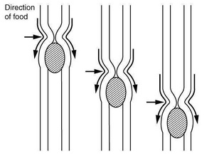 This image shows the peristaltic movement of food. In the left image, the food bolus is towards the top of the esophagus and arrows pointing downward show the direction of movement of the peristaltic wave. In the center image, the food bolus and the wave movement are closer to the center of the esophagus and in the right image, the bolus and the wave are close to the bottom end of the esophagus.