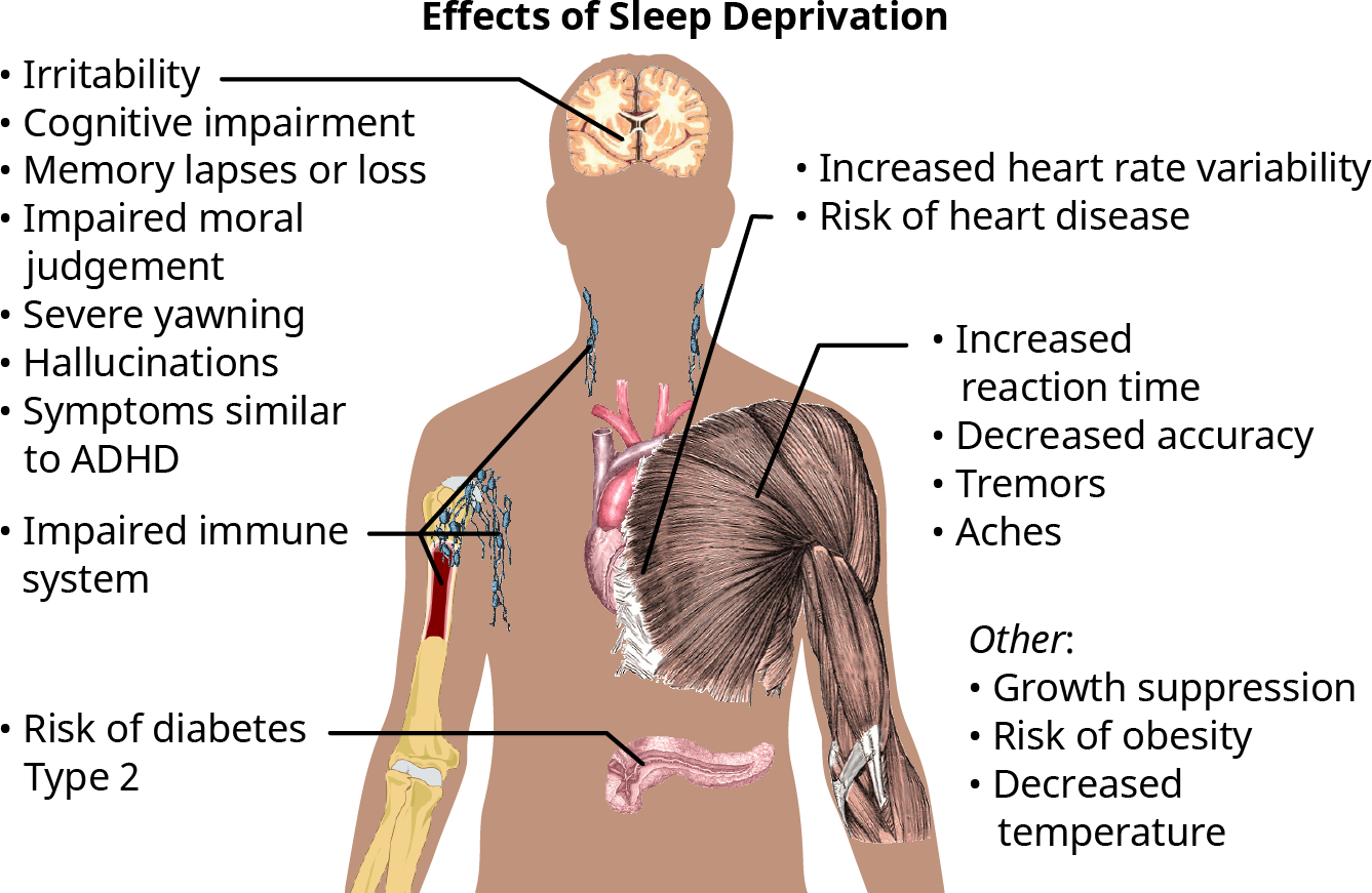 Diagram titled “Effects of Sleep Deprivation,” showing lines from the brain, heart, muscles, pancreas, and bones to labels describing negative impacts on each system.
