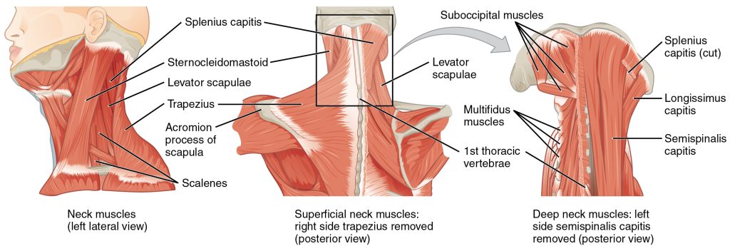Illustration showing neck muscles from three different views, with labels