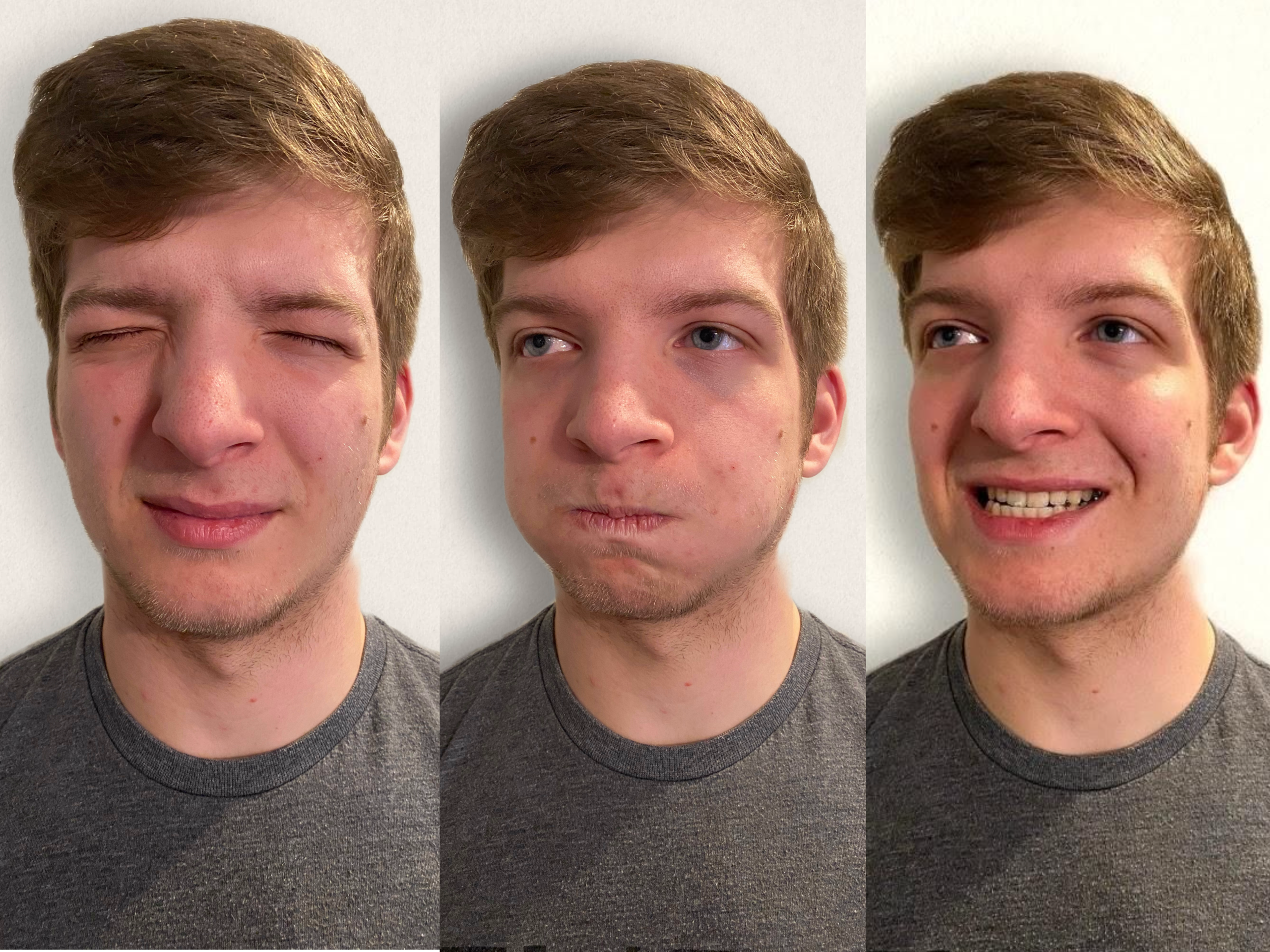 Photo of simulated patient making three different faces