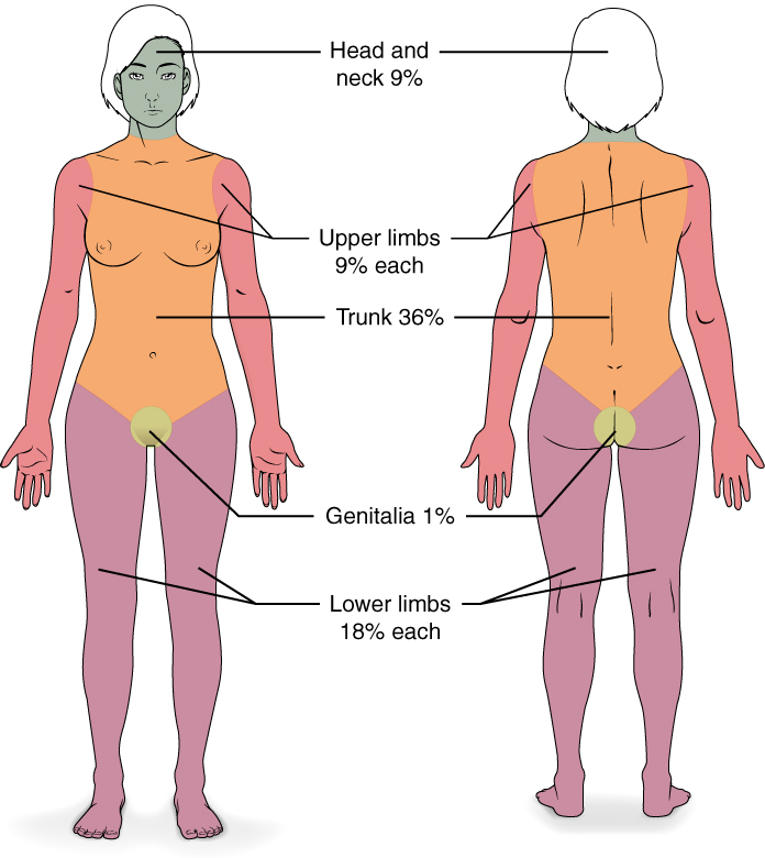 Illustration showing front and back of female figure, labeled for rule of nines for severe burn designation