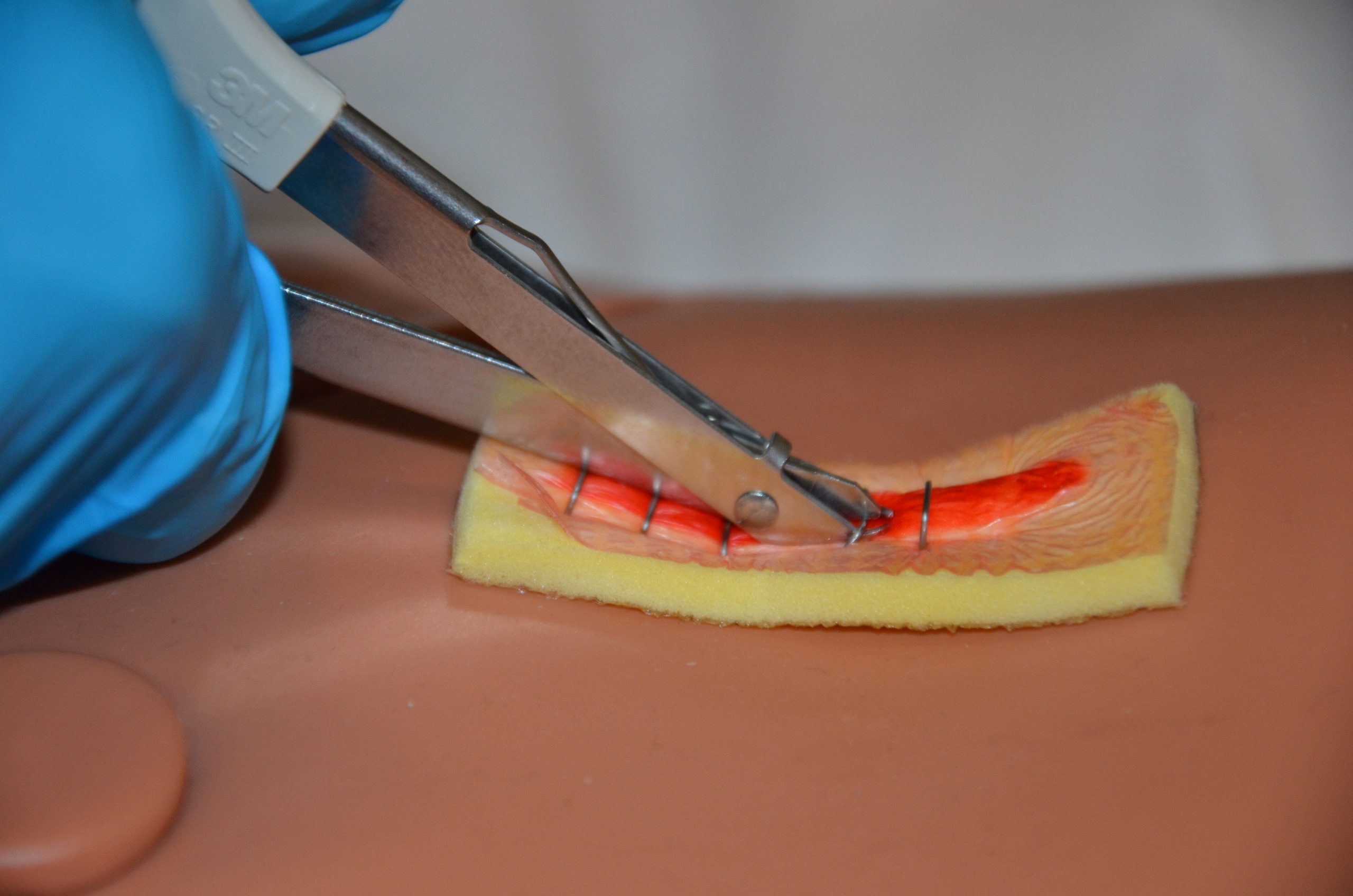 Continue to remove every second staple to the end of the incision line