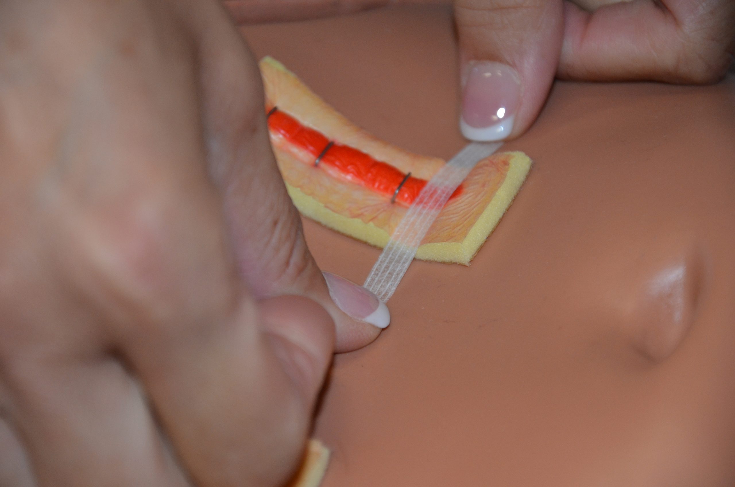 Cut Steri-Strips to allow them to extend 1.5 to 2 cm on each side of incision