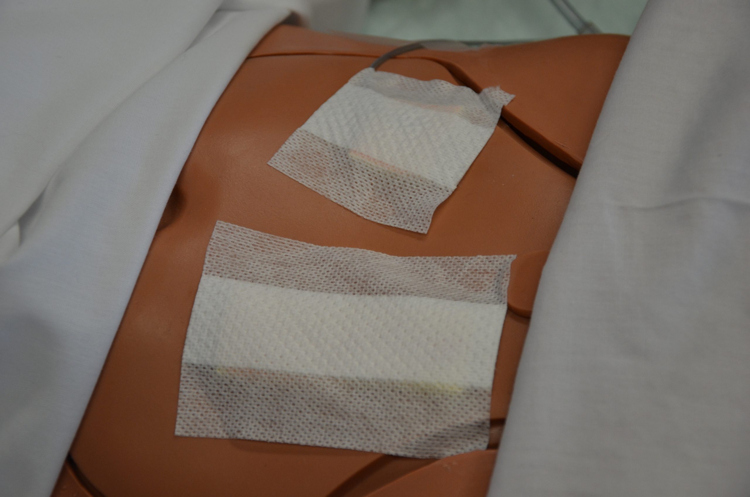 Prepare patient and expose wound