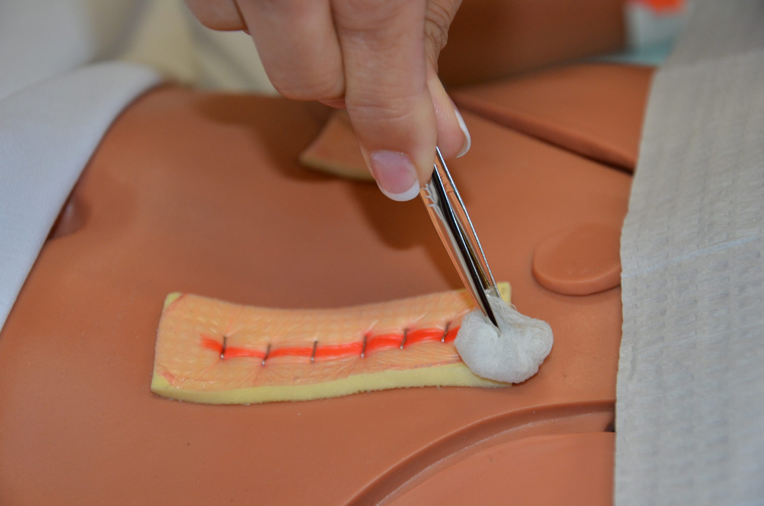 With another sterile swab or gauze, start at the centre of the incision and work toward the other end.