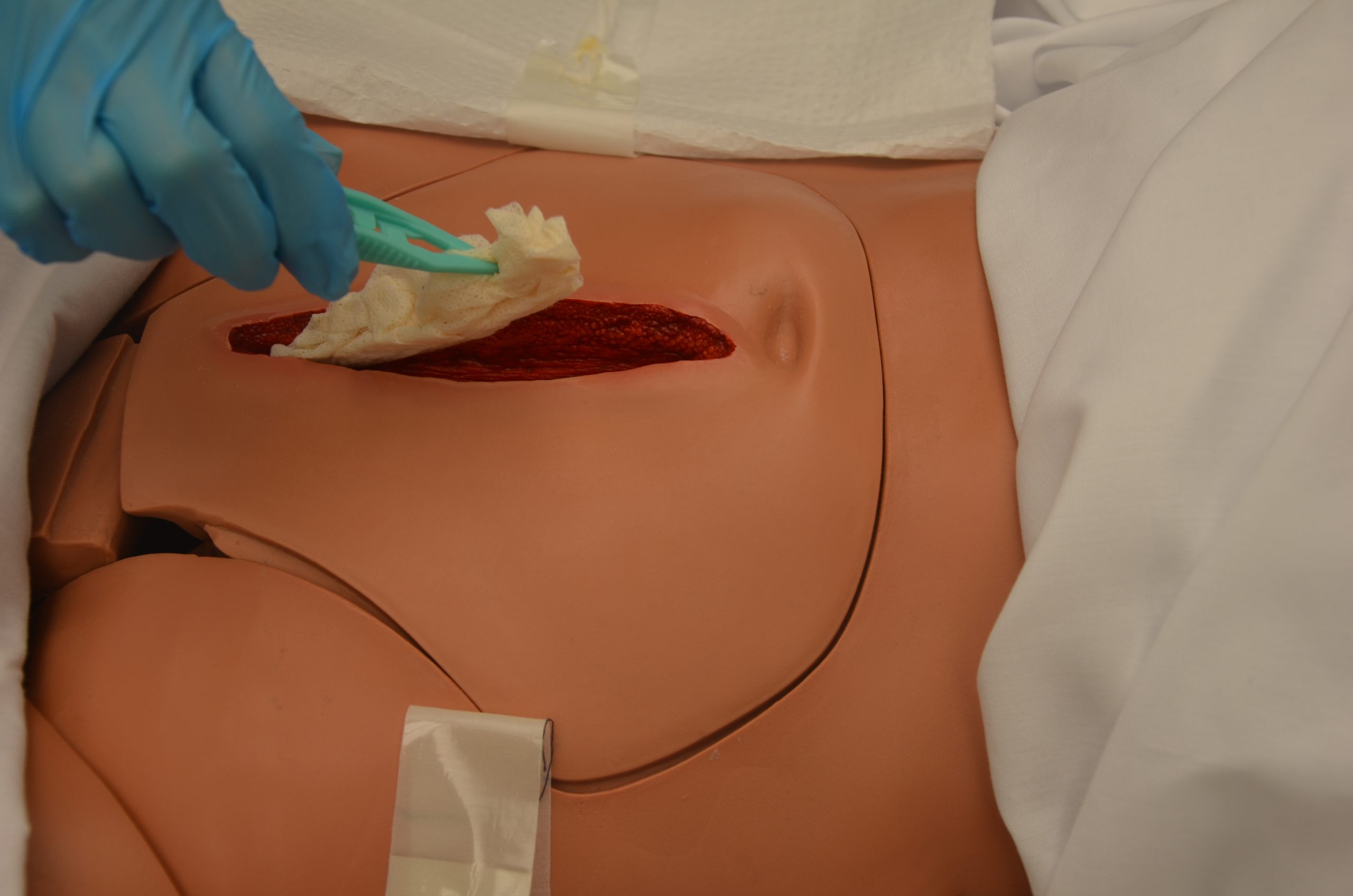 Remove inner dressing