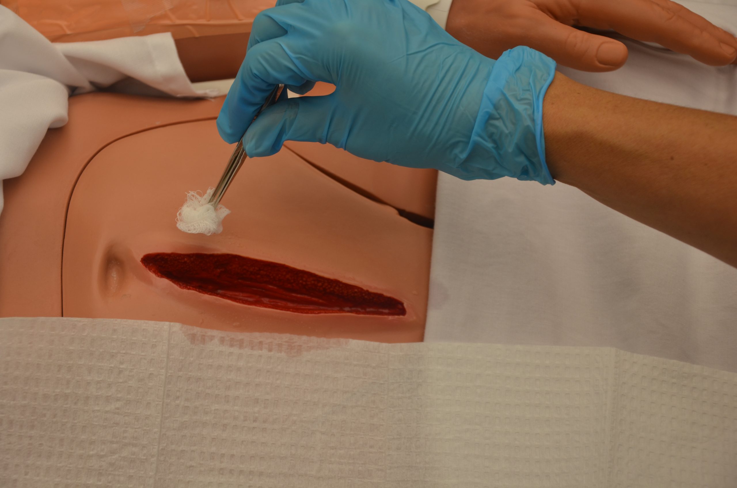 Dry wound edges with sterile gauze