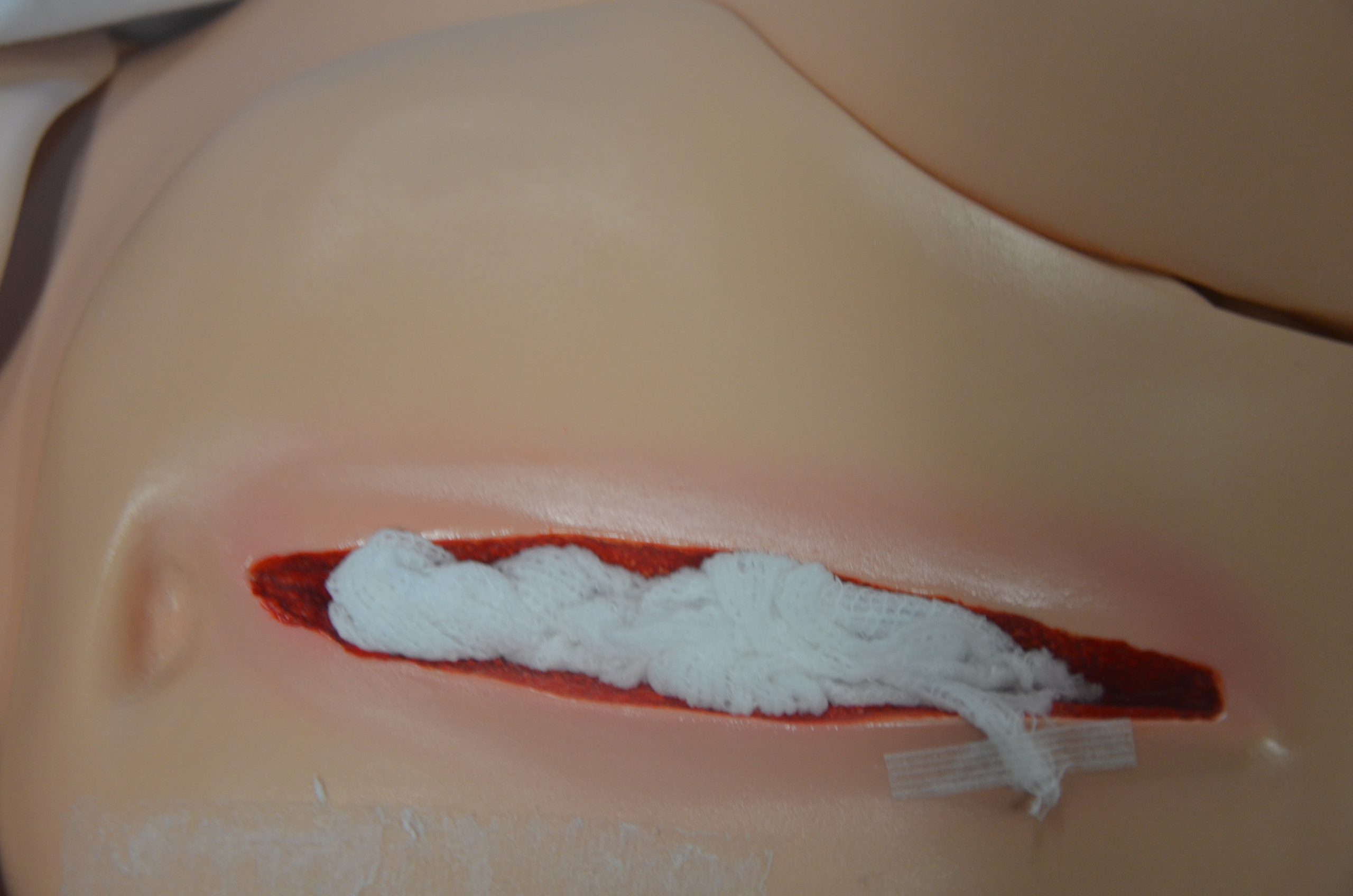 leave a “tail” of packing materials