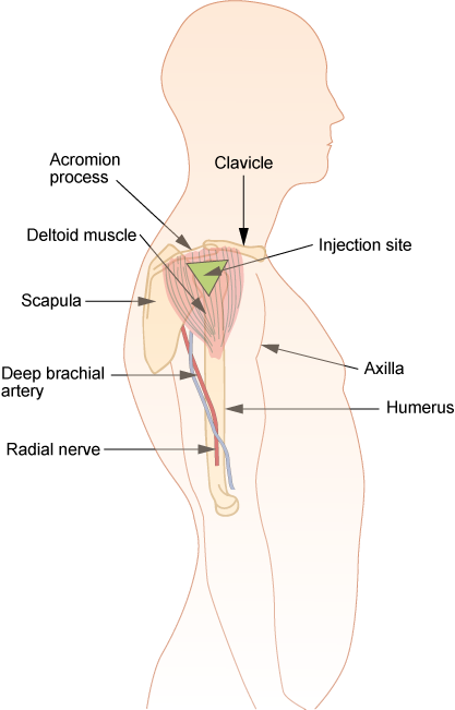 “Im-deltoid.png” by British Columbia Institute of Technology (BCIT) is licensed under CC BY 4.0. Access for free at https://opentextbc.ca/clinicalskills/chapter/6-7-intradermal-subcutaneous-and-intramuscular-injections/ Illustration showing how to Locate the Deltoid Injection Site