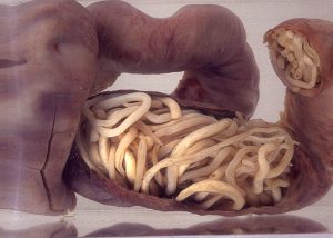 “Piece_of_intestine,_blocked_by_worms_(16424898321).jpg” by SuSanA Secretariat is licensed under CC BY 2.0 Image showing segment of intestine blocked by worms
