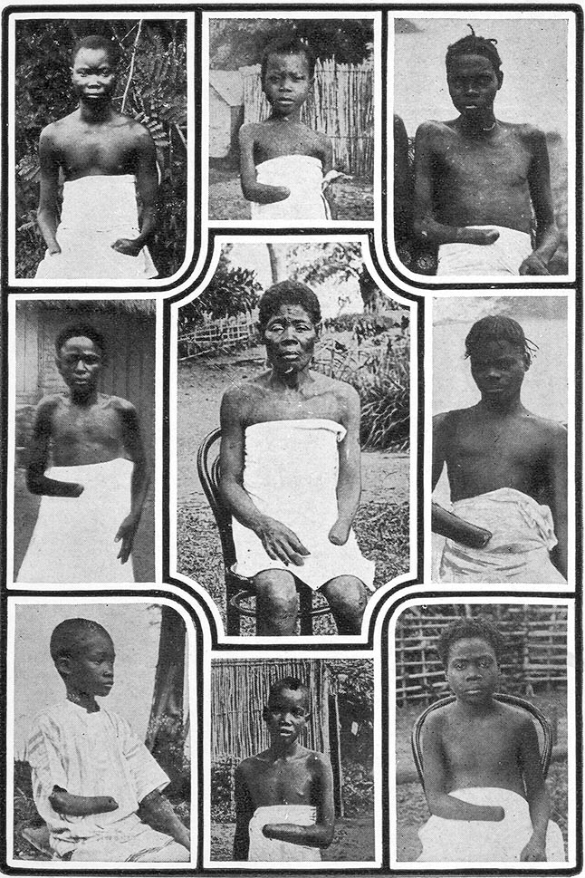 Photographic portraits of 8 different Congolese children missing hands from being mutilated