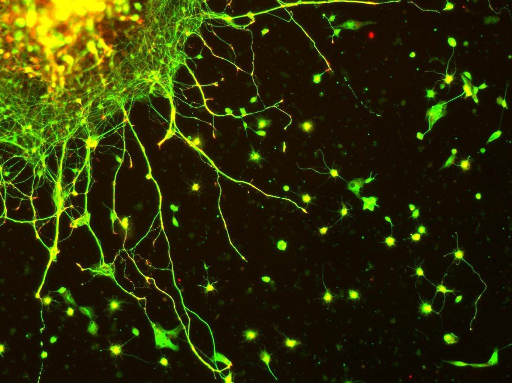Images of neurons in vitro color.