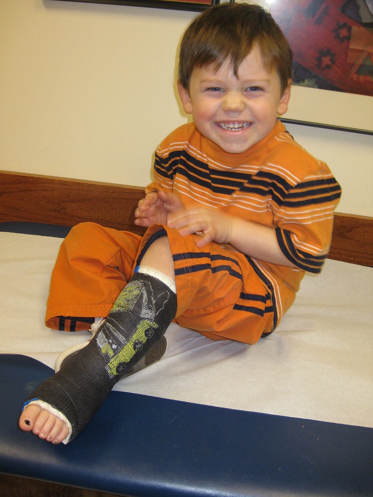 A child smiling with a cast on their leg