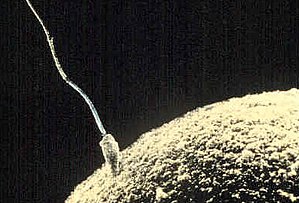 Sperm fusing (fertilizing) with an egg (ovum); the size of the sperm as it makes contact is emphasized by the egg