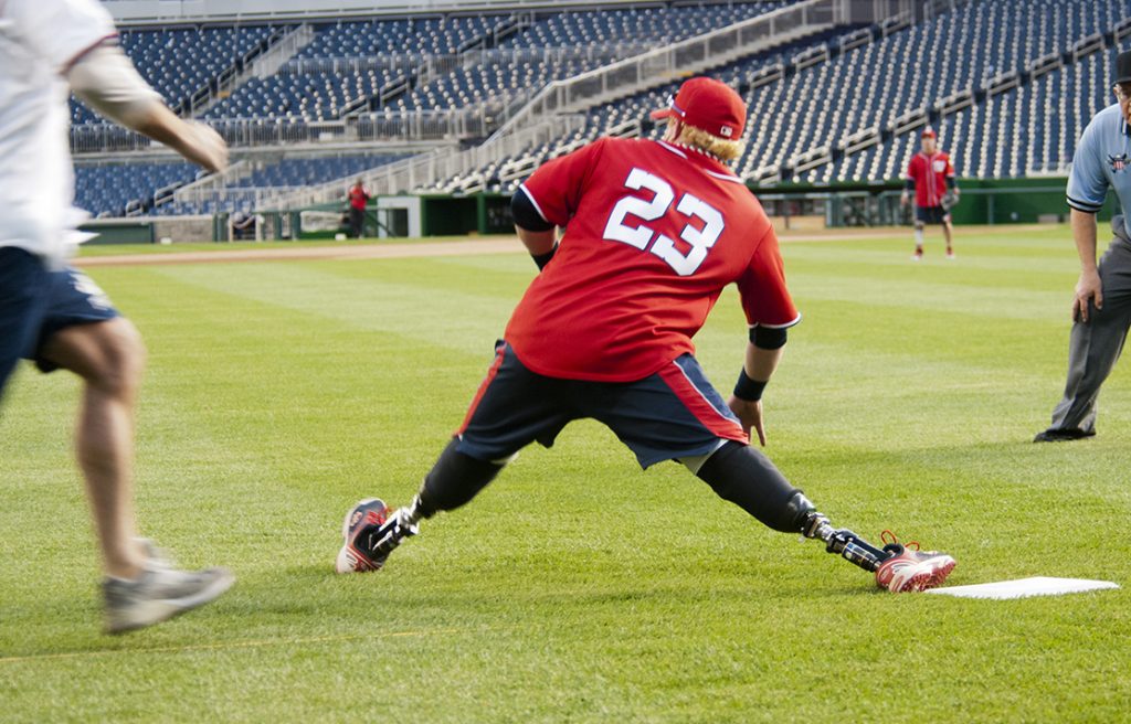 Photo shows a man with prosthetic legs stretching out while playing baseball.