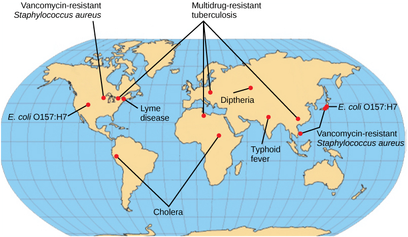 Emerging or re-emerging bacterial diseases are shown on a world map. Multidrug resistant tuberculosis is emerging in North America, Europe, and Asia. Vancomycin resistant Staphylococcus aureus and E coli O 1 5 7 colon H 7 are emerging in North America and East Asia. Lyme disease is spreading in North America. Cholera is emerging in Africa and South America. Diptheria and typhoid fever are re emerging in Asia.