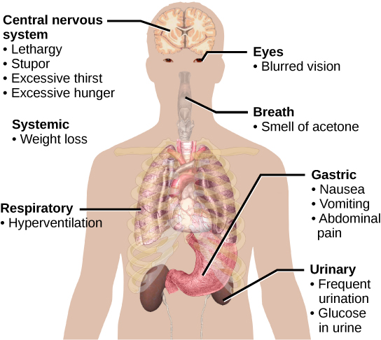 Symptoms of diabetes that affect the central nervous system include excessive thirst, excessive hunger, lethargy and stupor. It affects the eyes via blurred vision. A systemic issue is weight loss. It causes breath that smells like acetone, and affects the respiratory system through hyperventilation. Some of the gastric issues caused are nausea, vomiting, and abdominal pain. The urinary issues caused include frequent urination, and glucose in the urine.