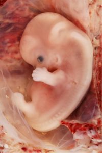Photo shows a human fetus, with a large bent head and a dark eye, fingers on its arm and a leg bud. The spine is visible through the back, and the stomach protrudes out as far as the leg bud.