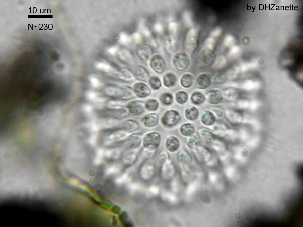 Image is a A Colonial Choanoflagellate. It appears to be a central structure with a series of circular cells on its surface.