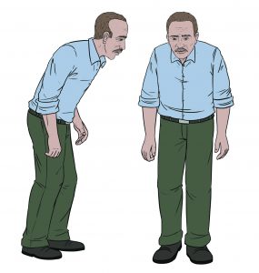 Illustration shows a hunched man with stiff arms and a shuffling walk.