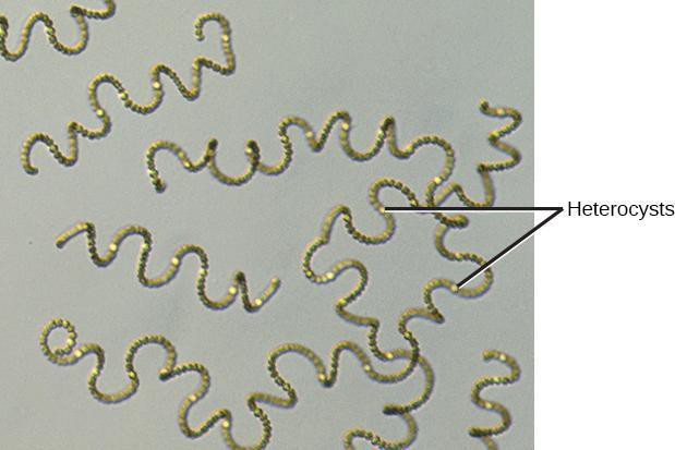 Several strands of Anabaena, a filamentous cyanobacteria.