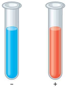 Illustration of two test tubes, one with distilled water, one with glucose test solution, each with Benedict solution added. The distilled water is blue and negative, the glucose solution is orange and positive.