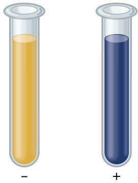 Illustration of two test tubes, one with distilled water, one with starch test solution, each with Lugol’s solution added. The distilled water is blue and negative, the starch solution is purple-black and positive.