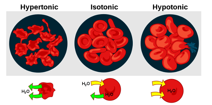 Osmotic pressure on blood cells diagram demonstrating how in a hypertonic solution, water will be drawn out; in an isotonic solution, water will exchange equally; and in a hypotonic solution, water will be drawn in.