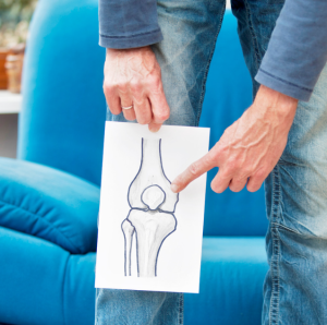 A photograph of a man holding an illustration of knee joints in front of his knee