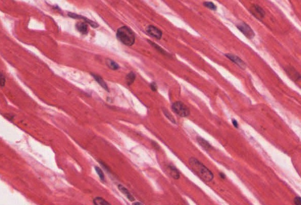 A micrograph shows cardiac muscle appearing like a woven basket with conspicuous internal nuclei.