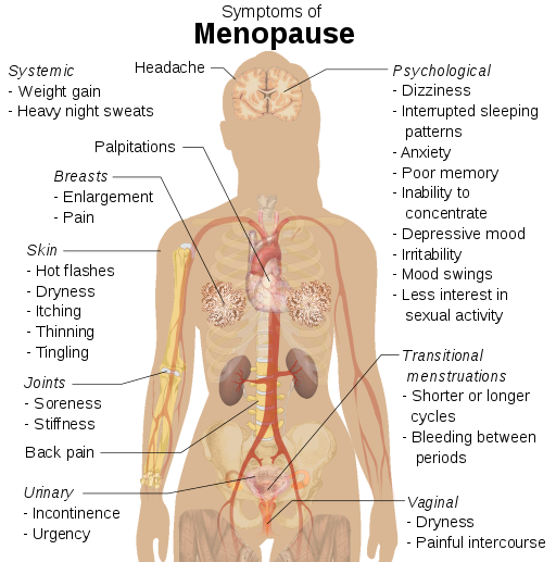 Illustration of female anatomy, listing the symptoms of menopause.