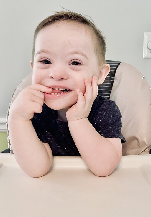 A photo of a 2-year-old boy with Down Syndrome.