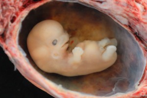 Photo shows a human embryo at approximately six weeks gestational age.