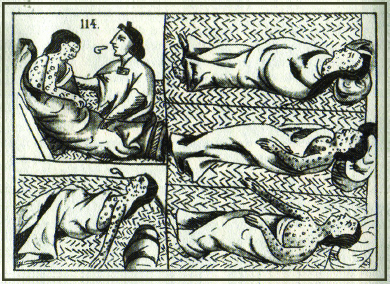 A drawing shows five depictions of an Aztec smallpox victim.
